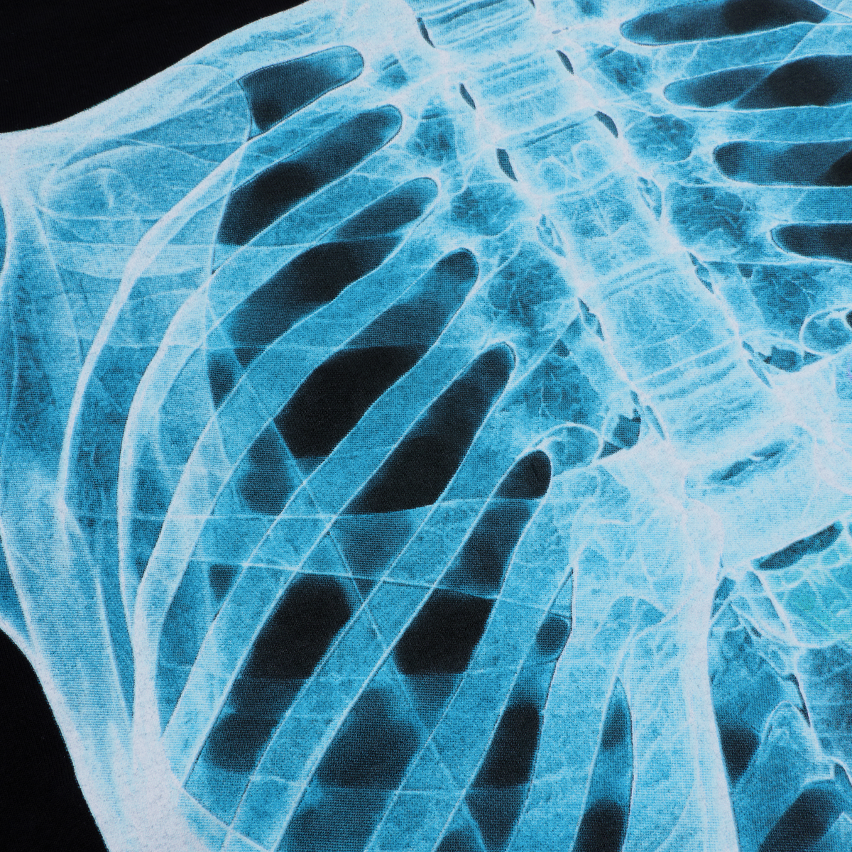 SHIELD POTION X-RAY TEE